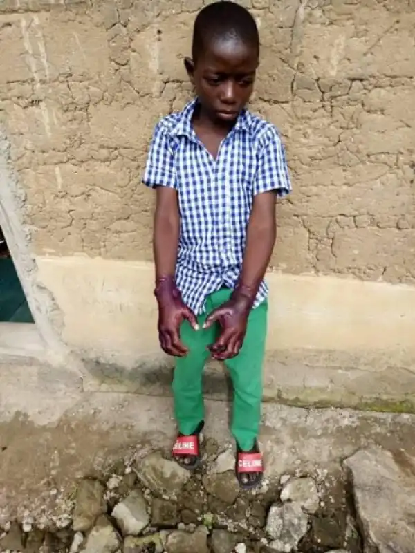 Woman Burns The Hands Of Her Stepson In Nasarawa (Viewers